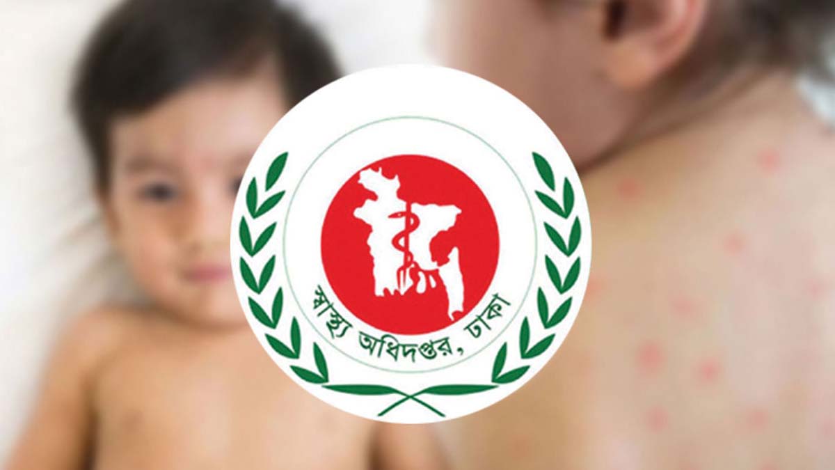 হাম উপসর্গে ২৪ ঘণ্টায় আরও ৩ শিশুর মৃত্যু