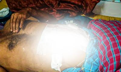 দিনাজপুরে ছুরিকাঘাতে দুইজনের পেটে আঘাত