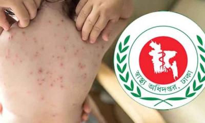 দেশে হাম ও হামের উপসর্গে আরও ৪ শিশুর মৃত্যু