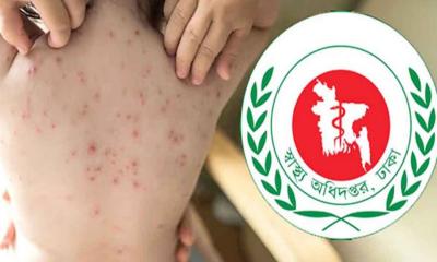 ২৪ ঘণ্টায় হামের উপসর্গে আরও ৭ শিশুর মৃত্যু
