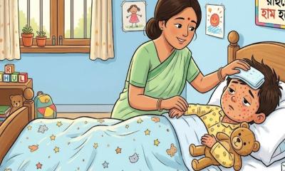দেশে হাম ও উপসর্গে আরও ৫ শিশুর মৃত্যু