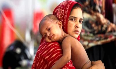 হামের উপসর্গে আরও ১১ মৃত্যু: মোট প্রাণহানি ১ হাজার ৭৬