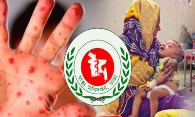 হামের উপসর্গে আরও ৩ শিশুর মৃ`ত্যু