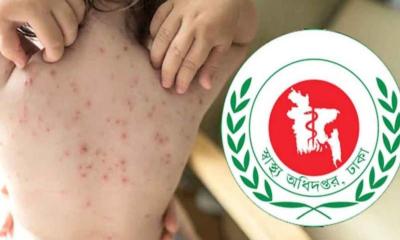 বাংলাদেশে হামের প্রাদুর্ভাব উচ্চ ঝুঁকির সতর্কতা ডব্লিউএইচও-র