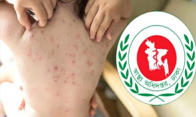 ২৪ ঘণ্টায় হাম উপসর্গে আরও ১১ শিশুর মৃ‍‍`ত্যু