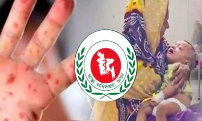হামের প্রকোপ কমছে না, ফের ২ শিশুর প্রাণহানি