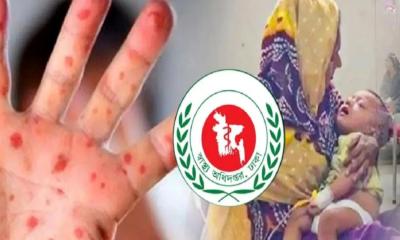 ২৪ ঘণ্টায় হাম ও উপসর্গ নিয়ে মৃত্যু ৭