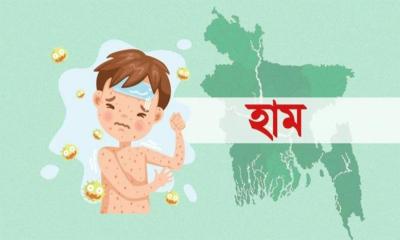 দেশে ২৪ ঘণ্টায় হাম ও উপসর্গ নিয়ে ৯ জনের মৃত্যু