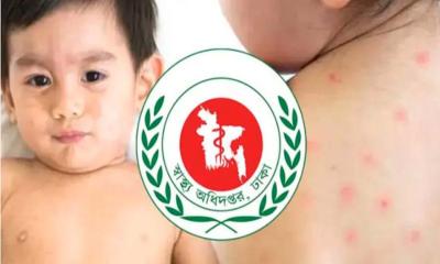 ২৪ ঘণ্টায় হাম ও উপসর্গে প্রাণ হারাল ৭ শিশু