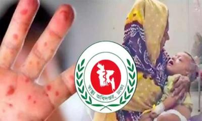 ২৪ ঘণ্টায় হাম ও উপসর্গে ১৩ শিশুর মৃ‍‍`ত্যু