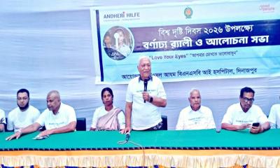 চোখ অমূল্য সম্পদ তাই যত্নশীল হোন