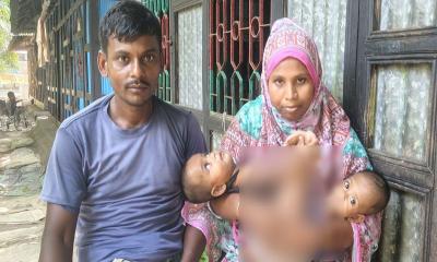 জোড়া লাগা যমজ দুই মেয়েকে বাঁচাতে সরকারের সহায়তা চান দিনমজুর বাবা