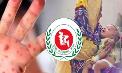 হামের উপসর্গ নিয়ে দেশে ২৪ ঘণ্টায় আরও ৬ শিশুর মৃত্যু