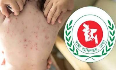 হামের প্রকোপ: ২৪ ঘণ্টায় আরও ৪ শিশুর মৃত্যু