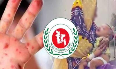 দেশে হামের প্রকোপ আরও বাড়ল, ২৪ ঘণ্টায় ৫ শিশুর মৃত্যু