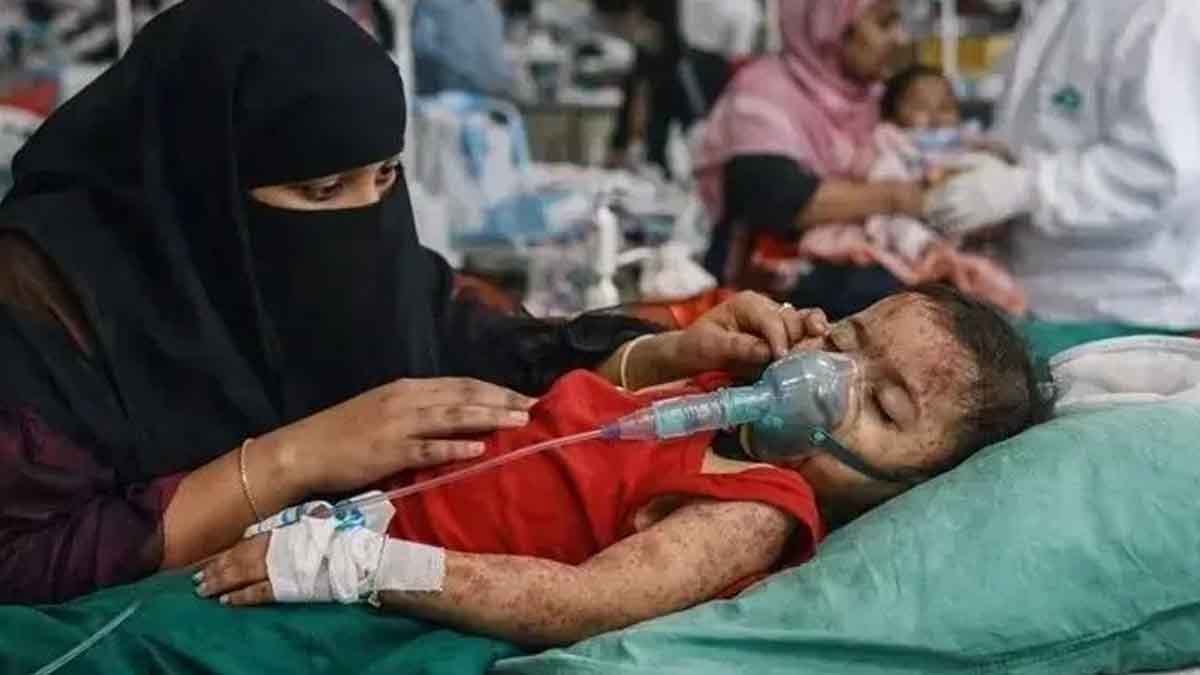 দেশে হাম ও হামের উপসর্গে ২৪ ঘণ্টায় আরও ৩ জনের মৃ‍‍`ত্যু