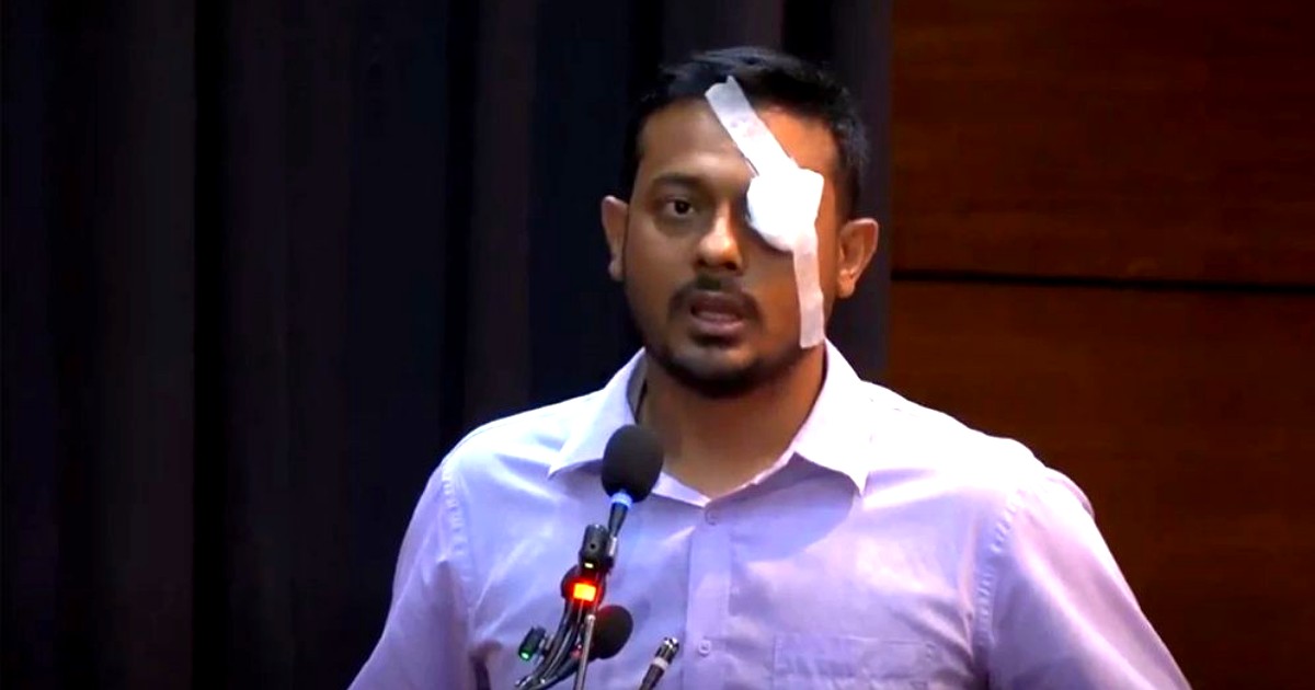 চোখে ব্যান্ডেজ বাঁধলেন এনসিপি নেতা নাসীরুদ্দীন