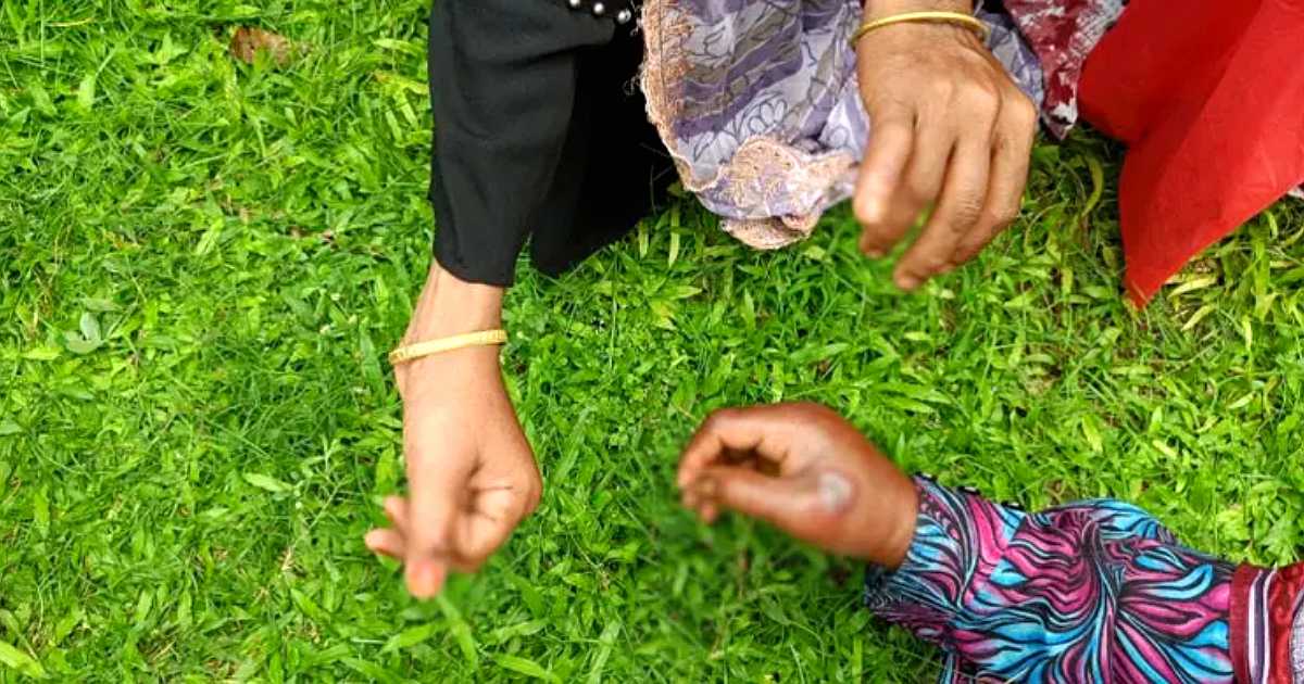 সুন্দরগঞ্জে অ্যানথ্রাক্সের উপসর্গ: নতুন করে আরও তিন রোগী