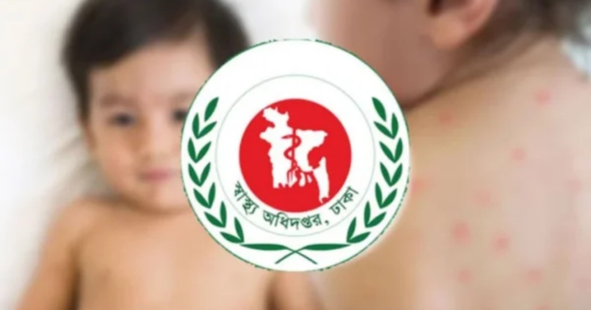 হাম উপসর্গে এক দিনে ৯ মৃত্যু