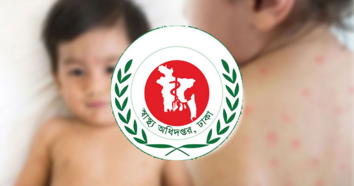 দেশে হাম ও উপসর্গে ২৪ ঘণ্টায় ১২ শিশুর মৃ‍‍`ত্যু