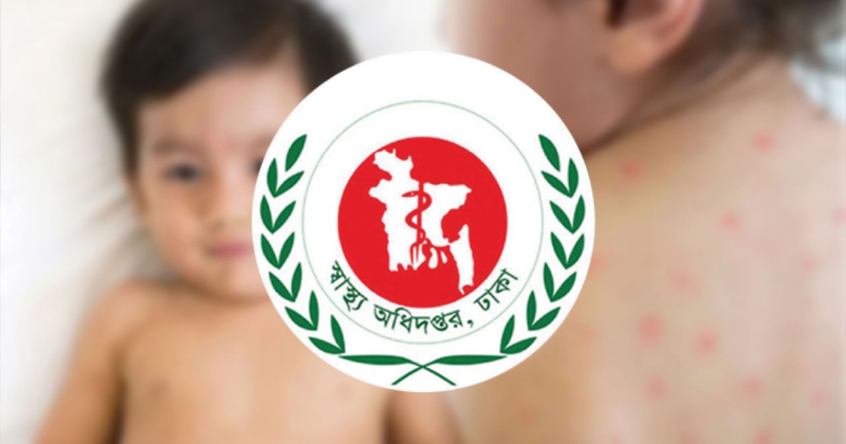 হাম ও উপসর্গে আরও ১২ জনের মৃ’ত্যু
