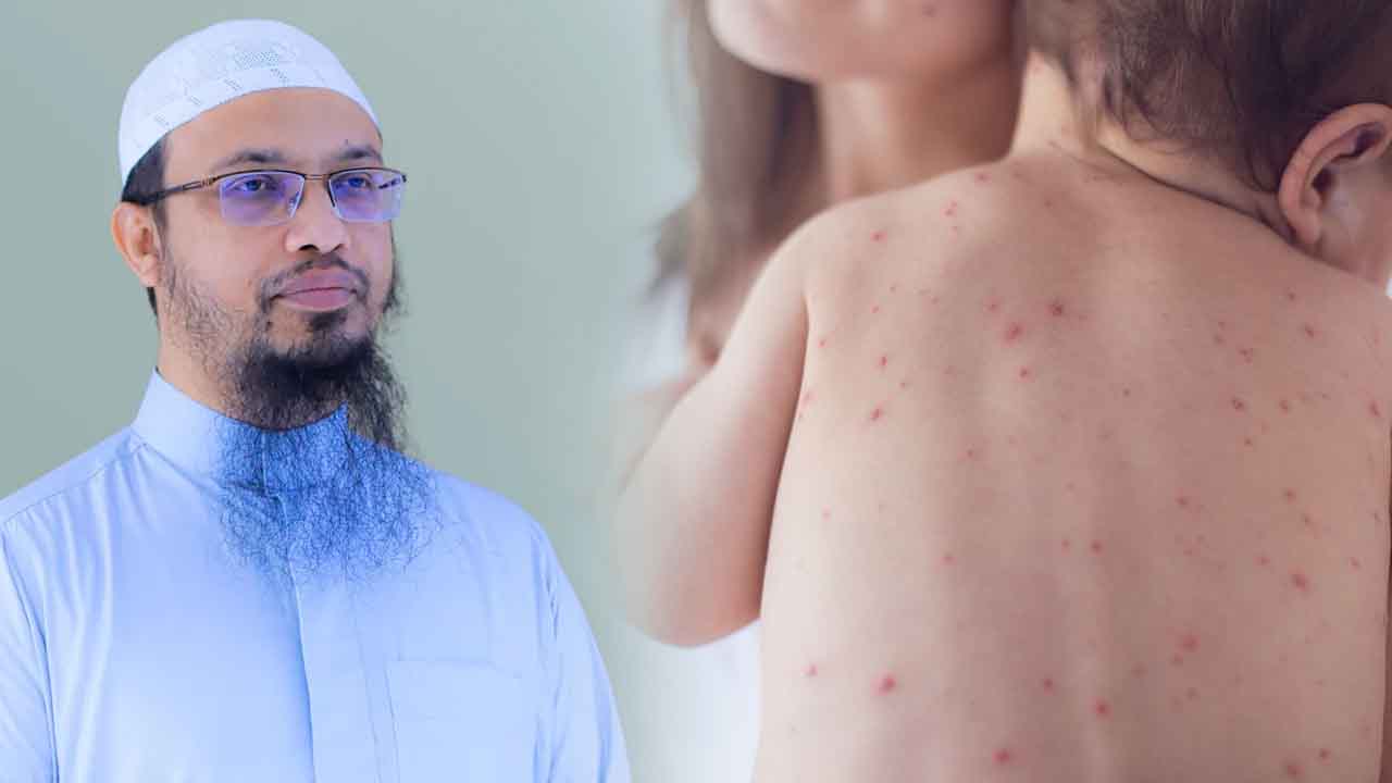 শিশুর হাম নিয়ে অভিভাবকদের যে বার্তা দিলেন আহমাদুল্লাহ